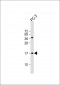 NDUF3 Antibody (N-term)